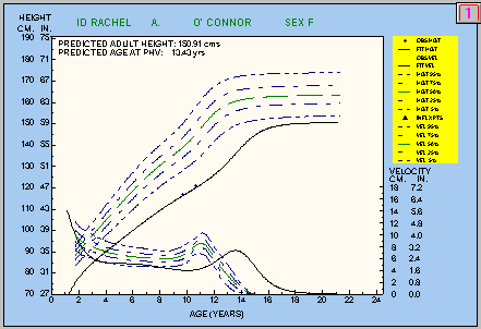 AUXAL Graph